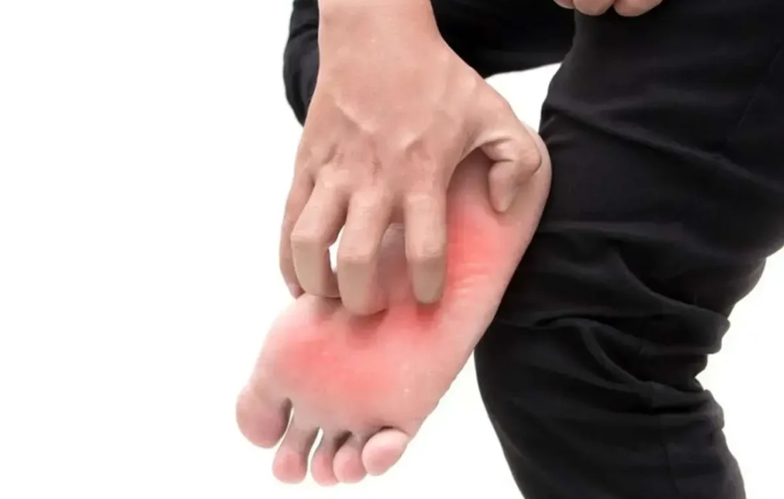 خارش کف پا؛ مشکل کوچک یا نشانه بیماری جدی؟