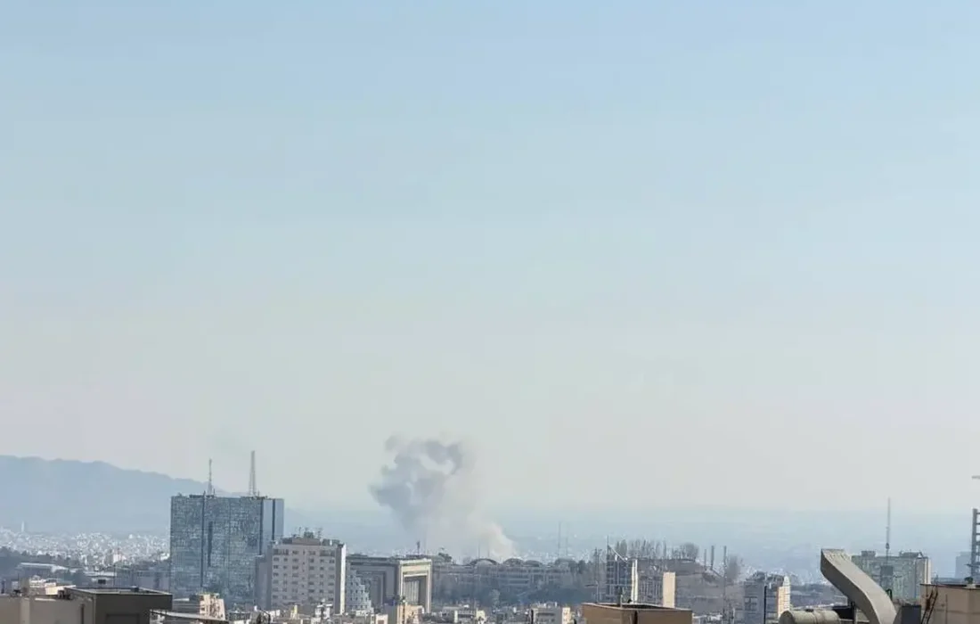 جزئیات مجروح شدن یک بازیگر در پی حمله آمریکا+ عکس