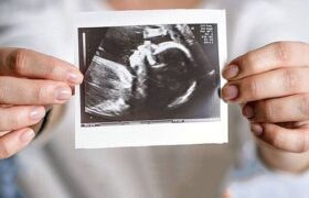 ویزیت رایگان مادران باردار ادامه دارد