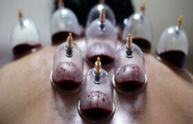 حجامت توسط افراد غیر متخصص خطرناک است
