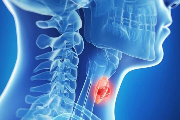 مهمترین بیماریهای غده تیروئید را بشناسید