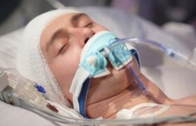 ضربه به سر ممکن است سلامت روده را مختل کند